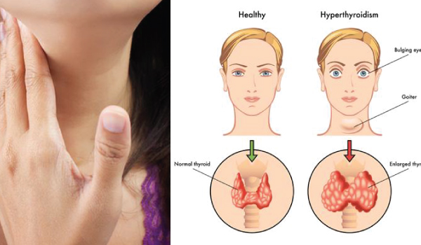 Endocrinology & Metabolism Department